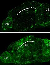 In vivo Blood-brain Barrier Permeability Assays Using Clostridium perfringens Epsilon Toxin