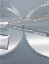 Co-culture of Murine Neurons Using a Microfluidic Device for The Study of Tau Misfolding Propagation