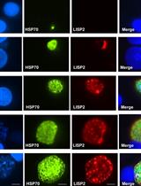 <em>In vitro</em> Cultivation and Visualization of Malaria Liver Stages in Primary Simian Hepatocytes