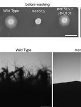 Candida albicans Agar Invasion Assays