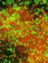 Evaluation of Viable Cells in Pseudomonas aeruginosa Biofilms by Colony Count and Live/Dead Staining