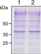 Expression and Purification of Arabidopsis Transmembrane Protein BCM1 in  Saccharomyces cerevisiae