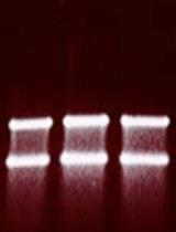 Whole-genome Identification of Transcriptional Start Sites by Differential RNA-seq in Bacteria