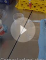 Isolation and ex vivo Expansion of Human Limbal Epithelial Progenitor Cells