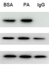 Immunoprecipitation of Acetyl-lysine and Western Blotting of Long-chain acyl-CoA Dehydrogenases and Beta-hydroxyacyl-CoA Dehydrogenase in Palmitic Acid Treated Human Renal Tubular Epithelial Cells