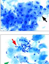 Surgical Induction of Endometriosis in Female Mice
