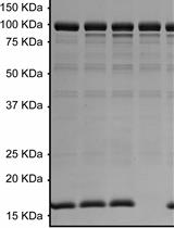 Radioactive Assay of in vitro Glutamylation Activity of the Legionella pneumophila Effector Protein SidJ
