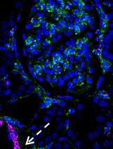 Double Labeling of PDGFR-β and α-SMA in Swine Models of Acute Kidney Injury to Detect Pericyte-to-Myofibroblast Transdifferentation as Early Marker of Fibrosis