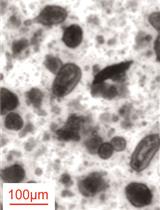 Fluidigm Based Single-cell Gene Expression Library Preparation from Patient-derived Small Intestinal Organoids