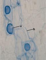 Acidified Blue Ink-staining Procedure for the Observation of Fungal Structures Inside Roots of Two Disparate Plant Lineages