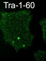 Derivation of Induced Pluripotent Stem Cells from Human Fibroblasts Using a Non-integrative System in Feeder-free Conditions