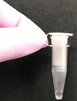 唾液中带电荷代谢产物的毛细管电泳与飞行时间质谱联用定量分析