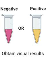 A Protocol for Simple, Rapid, and Direct Detection of SARS-CoV-2 from clinical samples, using Reverse Transcribed Loop-Mediated Isothermal Amplification (RT-LAMP)