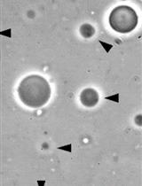 Generation of Giant Unilamellar Vesicles (GUVs) Using Polyacrylamide Gels