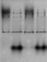 <em>In vitro</em> Glutamylation Inhibition of Ubiquitin Modification and Phosphoribosyl-Ubiquitin Ligation Mediated by <em>Legionella pneumophila</em> Effectors