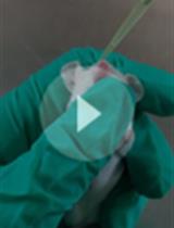 铜绿假单胞菌肺部感染的小鼠急性肺炎模型