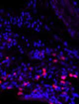 Advances in Proximity Ligation in situ Hybridization (PLISH)