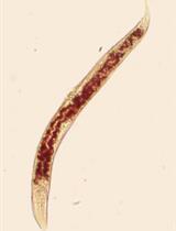 Total Triglyceride Quantification in Caenorhabditis elegans