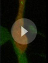 In vitro Time-lapse Imaging of Primary Cilium in Migrating Neuroblasts