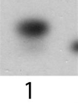 Charging State Analysis of Transfer RNA from an α-proteobacterium