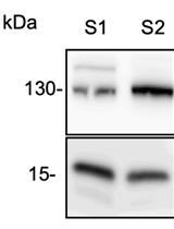 Native Co-immunoprecipitation Assay to Identify Interacting Partners of Chromatin-associated Proteins in Mammalian Cells