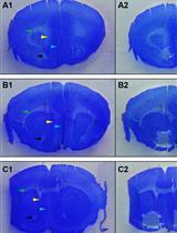 Using the Parafilm-assisted Microdissection (PAM) Method to Sample Rodent Nucleus Accumbens