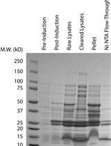重组Skd3（人ClpB）蛋白和烟草蚀刻病毒（TEV）蛋白酶在大肠杆菌中的表达与纯化
