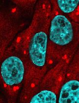 A Quantitative Assay to Measure Stress Granule Association of Proteins and Peptides in Semi-permeabilized Human Cells