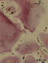 Differentiation of Human Induced Pluripotent Stem Cells (hiPSCs) into Osteoclasts