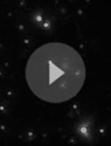 超速离心法分离间充质基质细胞胞外囊泡