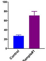 HeLa细胞中三酰甘油的测定