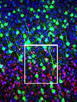 Optimized Immunostaining of Embryonic and Early Postnatal Mouse Brain Sections