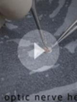 小鼠巩膜脉络膜/视网膜色素上皮/视网膜不分离染色及用于视网膜下层整体观察的全组织染色法