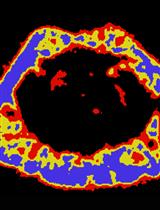 Measuring Bone Volume at Multiple Densities by Micro-computed Tomography