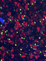 A Transient Transfection-based Cell Adhesion Assay with 293T Cells