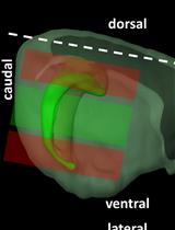 Characterization of Hippocampal Adult-borne Granule Cells in a Transient Cerebral Ischemia Model