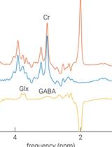Low- and High-resolution Dynamic Analyses for Magnetic Resonance Spectroscopy Data