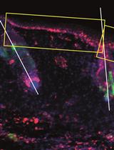 Histological and Immunohistochemical Examination of Stem Cell Proliferation and Reepithelialization in the Wounded Skin