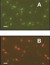 Determination of Antibacterial Activity of Film Coatings against Four Clinically Relevant Bacterial Strains