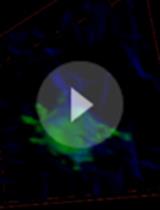 Imaging of Human Cancer Cells in 3D Collagen Matrices