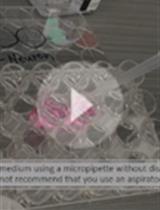 Rapid and Simplified Induction of Neural Stem/Progenitor Cells (NSCs/NPCs) and Neurons from Human Induced Pluripotent Stem Cells (hiPSCs)