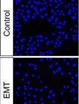 Induction of Epithelial-mesenchymal Transition in MDCK II Cells