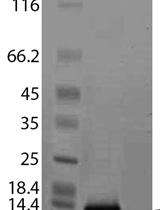 可溶性磷脂酶A2αC2结构域在大肠杆菌中表达后的纯化