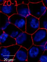 In vitro Measurement of Membrane Attack Complex in RPE Cells