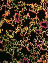 Bioorthogonal Labeling and Chemoselective Functionalization of Lung Extracellular Matrix