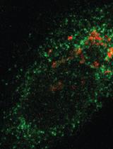 Retention Using Selective Hooks (RUSH) Cargo Sorting Assay for Protein Vesicle Tracking in HeLa Cells