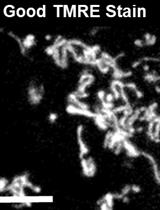 Strategy of Isolating ‘Primed’ Tumor Initiating Cells Based on Mitochondrial Transmembrane Potential