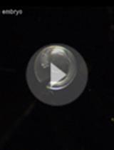 斑马鱼胚胎中央管中脑脊液流动和运动纤毛特性的自动分析