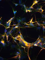 Generation of Human iPSC-derived Neural Progenitor Cells (NPCs) as Drug Discovery Model for Neurological and Mitochondrial Disorders