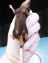 Transcardiac Perfusion of the Mouse for Brain Tissue Dissection and Fixation